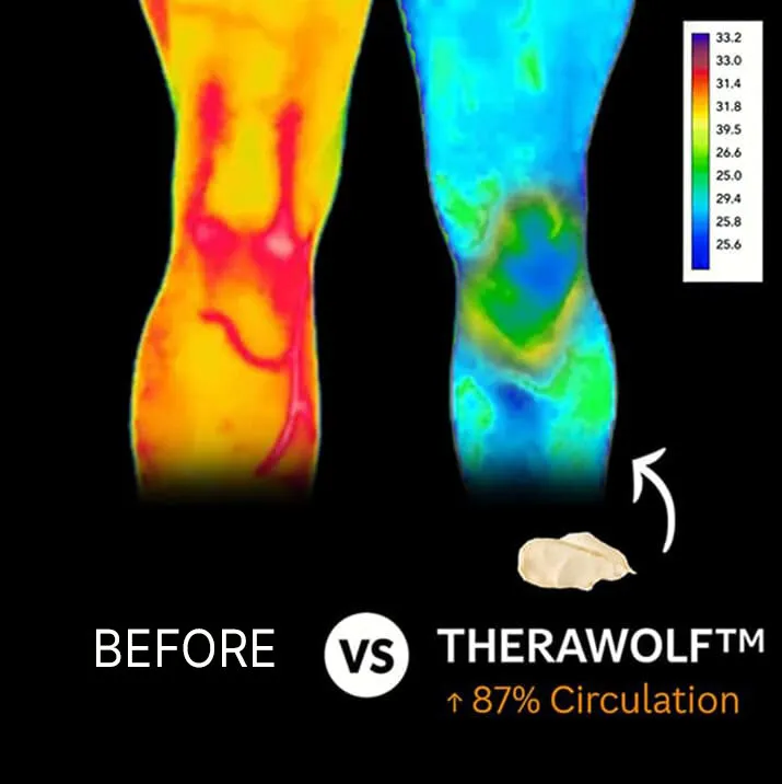 before and after knee pain relief showing improved circulation after using TheraWolf Neuro Balm